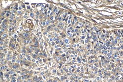 CD59 Mouse Monoclonal Antibody, Proteintech:Antibodies:Primary Antibodies