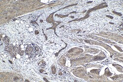 CD59 Mouse Monoclonal Antibody, Proteintech:Antibodies:Primary Antibodies