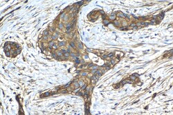 CD59 Mouse Monoclonal Antibody, Proteintech:Antibodies:Primary Antibodies