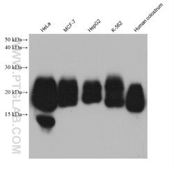 CD59 Mouse Monoclonal Antibody, Proteintech:Antibodies:Primary Antibodies
