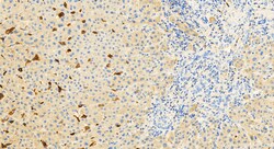 CD5L Rabbit Polyclonal Antibody, Proteintech Unconjugated; 150 &mu;L:Antibodies,