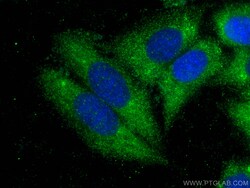 CD5L Rabbit Polyclonal Antibody, Proteintech Unconjugated; 150 &mu;L:Antibodies,