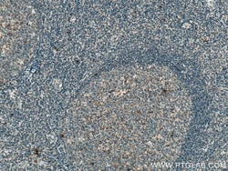 CD70 Mouse Monoclonal Antibody, Proteintech:Antibodies:Primary Antibodies