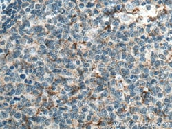CD70 Mouse Monoclonal Antibody, Proteintech:Antibodies:Primary Antibodies