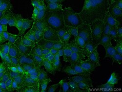 CoraLite Plus 488-conjugated CD71 Mouse Monoclonal Antibody, Proteintech:Antibodies:Primary