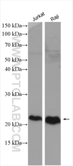 CD81 Rabbit Polyclonal Antibody, Proteintech Unconjugated; 20 &mu;L:Antikörper