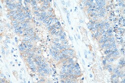Biotin-conjugated CD9 Mouse Monoclonal Antibody, Proteintech:Antibodies:Primary