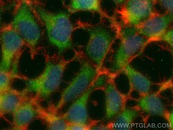 CDC20 Rabbit Polyclonal Antibody, Proteintech Unconjugated; 20 &mu;L:Anticuerpos