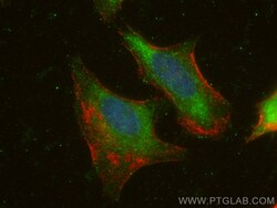 CDC20 Rabbit Polyclonal Antibody, Proteintech Unconjugated; 20 &mu;L:Anticuerpos