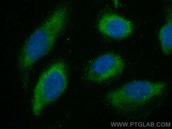 CDC20 Rabbit Polyclonal Antibody, Proteintech Unconjugated; 20 &mu;L:Anticuerpos