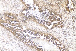 CDC20 Rabbit Polyclonal Antibody, Proteintech Unconjugated; 20 &mu;L:Anticuerpos
