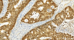 CDX2 Rabbit Recombinant Antibody, Proteintech Unconjugated; 20 &mu;L:Antibodies,