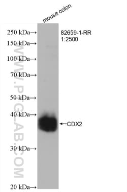 CDX2 Rabbit Recombinant Antibody, Proteintech Unconjugated; 20 &mu;L:Antibodies,