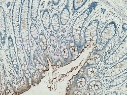 CEACAM7 Rabbit Polyclonal Antibody, Proteintech:Antibodies:Primary Antibodies
