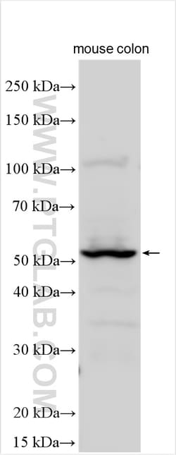 CEACAM7 Rabbit Polyclonal Antibody, Proteintech:Antibodies:Primary Antibodies