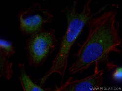 CEP120 Rabbit Polyclonal Antibody, Proteintech Unconjugated; 20 &mu;L:Antibodies,