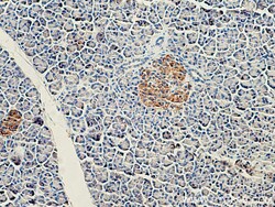 CEP120 Rabbit Polyclonal Antibody, Proteintech Unconjugated; 20 &mu;L:Antibodies,