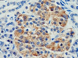 CEP120 Rabbit Polyclonal Antibody, Proteintech Unconjugated; 20 &mu;L:Antibodies,