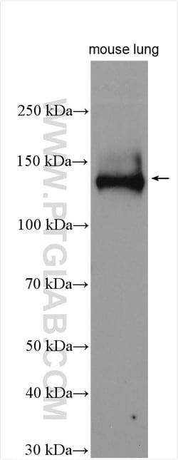 CEP120 Rabbit Polyclonal Antibody, Proteintech Unconjugated; 20 &mu;L:Antibodies,