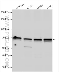 CETP Rabbit Polyclonal Antibody, Proteintech Unconjugated; 20 &mu;L:Antibodies,