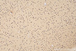 CHD2 Rabbit Polyclonal Antibody, Proteintech Unconjugated; 20 &mu;L:Antibodies,