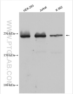 CHD2 Rabbit Polyclonal Antibody, Proteintech Unconjugated; 20 &mu;L:Antibodies,