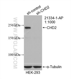 CHD2 Rabbit Polyclonal Antibody, Proteintech Unconjugated; 20 &mu;L:Antibodies,