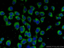 CHMP7 Mouse Monoclonal Antibody, Proteintech:Antibodies:Primary Antibodies