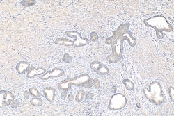 CHMP7 Mouse Monoclonal Antibody, Proteintech:Antibodies:Primary Antibodies