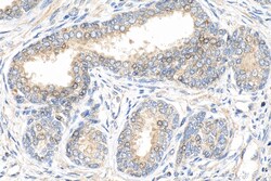 CHMP7 Mouse Monoclonal Antibody, Proteintech:Antibodies:Primary Antibodies