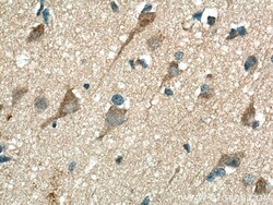 CHN1 Rabbit Polyclonal Antibody, Proteintech:Antibodies:Primary Antibodies