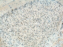 CHN1 Rabbit Polyclonal Antibody, Proteintech:Antibodies:Primary Antibodies