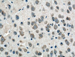CHN1 Rabbit Polyclonal Antibody, Proteintech:Antibodies:Primary Antibodies