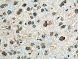 CHN1 Rabbit Polyclonal Antibody, Proteintech:Antibodies:Primary Antibodies