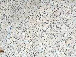 CHN1 Rabbit Polyclonal Antibody, Proteintech:Antibodies:Primary Antibodies
