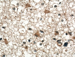 CHN1 Rabbit Polyclonal Antibody, Proteintech:Antibodies:Primary Antibodies