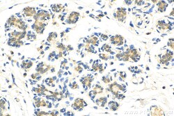 CIB1 Mouse Monoclonal Antibody, Proteintech Unconjugated; 150 &mu;L:Antibodies,