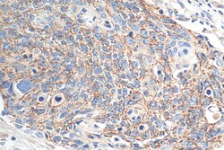 Claudin 7 Rabbit Polyclonal Antibody, Proteintech Unconjugated; 20 &mu;L:Antibodies,