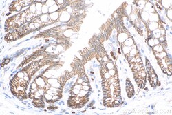 Claudin 7 Rabbit Polyclonal Antibody, Proteintech Unconjugated; 20 &mu;L:Antibodies,