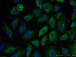 CLIP-115/CLIP2 Mouse Monoclonal Antibody, Proteintech:Anticorps:Anticorps