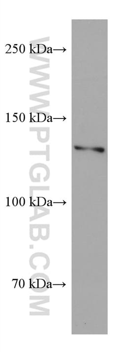 CLIP-115/CLIP2 Mouse Monoclonal Antibody, Proteintech:Anticorps:Anticorps