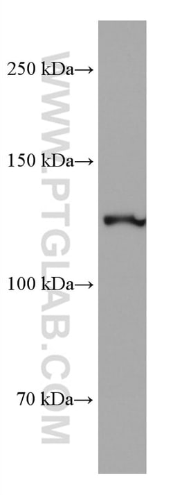 CLIP-115/CLIP2 Mouse Monoclonal Antibody, Proteintech:Anticorps:Anticorps