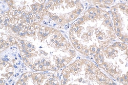CMPK2 Rabbit Polyclonal Antibody, Proteintech:Antibodies:Primary Antibodies