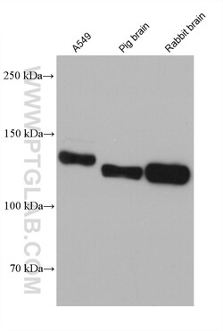CNTN1 Mouse Monoclonal Antibody, Proteintech Unconjugated; 20 &mu;L:Antibodies,