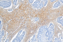 COL3A1 Mouse Monoclonal Antibody, Proteintech:Antibodies:Primary Antibodies