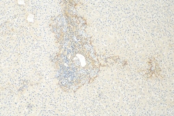 COL3A1 Mouse Monoclonal Antibody, Proteintech:Antibodies:Primary Antibodies