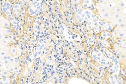 COL3A1 Mouse Monoclonal Antibody, Proteintech:Antibodies:Primary Antibodies