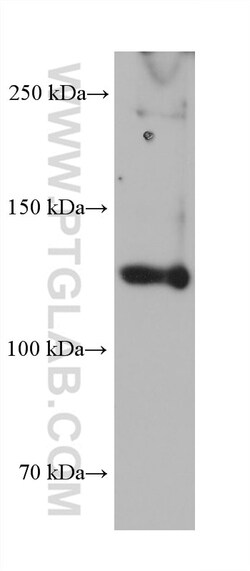 COL3A1 Mouse Monoclonal Antibody, Proteintech:Antibodies:Primary Antibodies