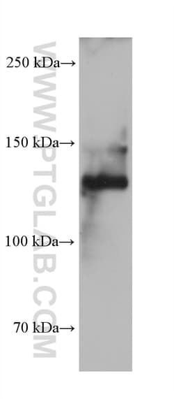 COL3A1 Mouse Monoclonal Antibody, Proteintech:Antibodies:Primary Antibodies