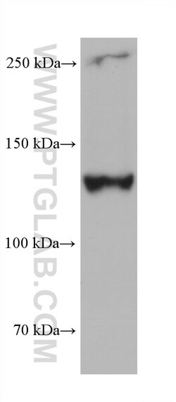 COL3A1 Mouse Monoclonal Antibody, Proteintech:Antibodies:Primary Antibodies